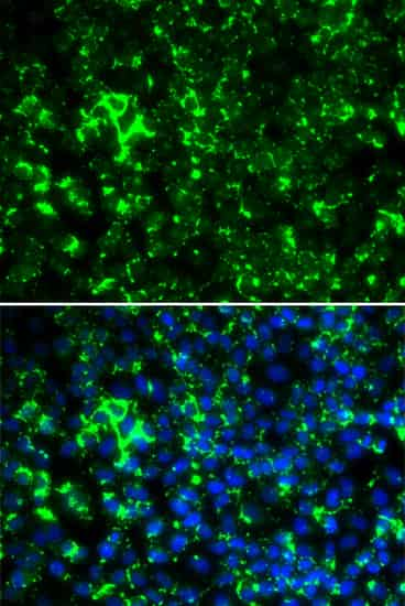 Immunofluorescence analysis of HeLa cells using KCNA2 Polyclonal Antibody