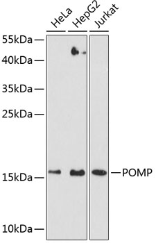 Western blot analysis of extracts of various cell lines using POMP Polyclonal Antibody at dilution of 1:3000.