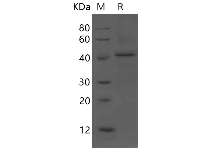Recombinant Rat Interleukin-12/IL-12 Protein (His Tag)-1