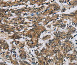 SYN1 Polyclonal Antibody - 3