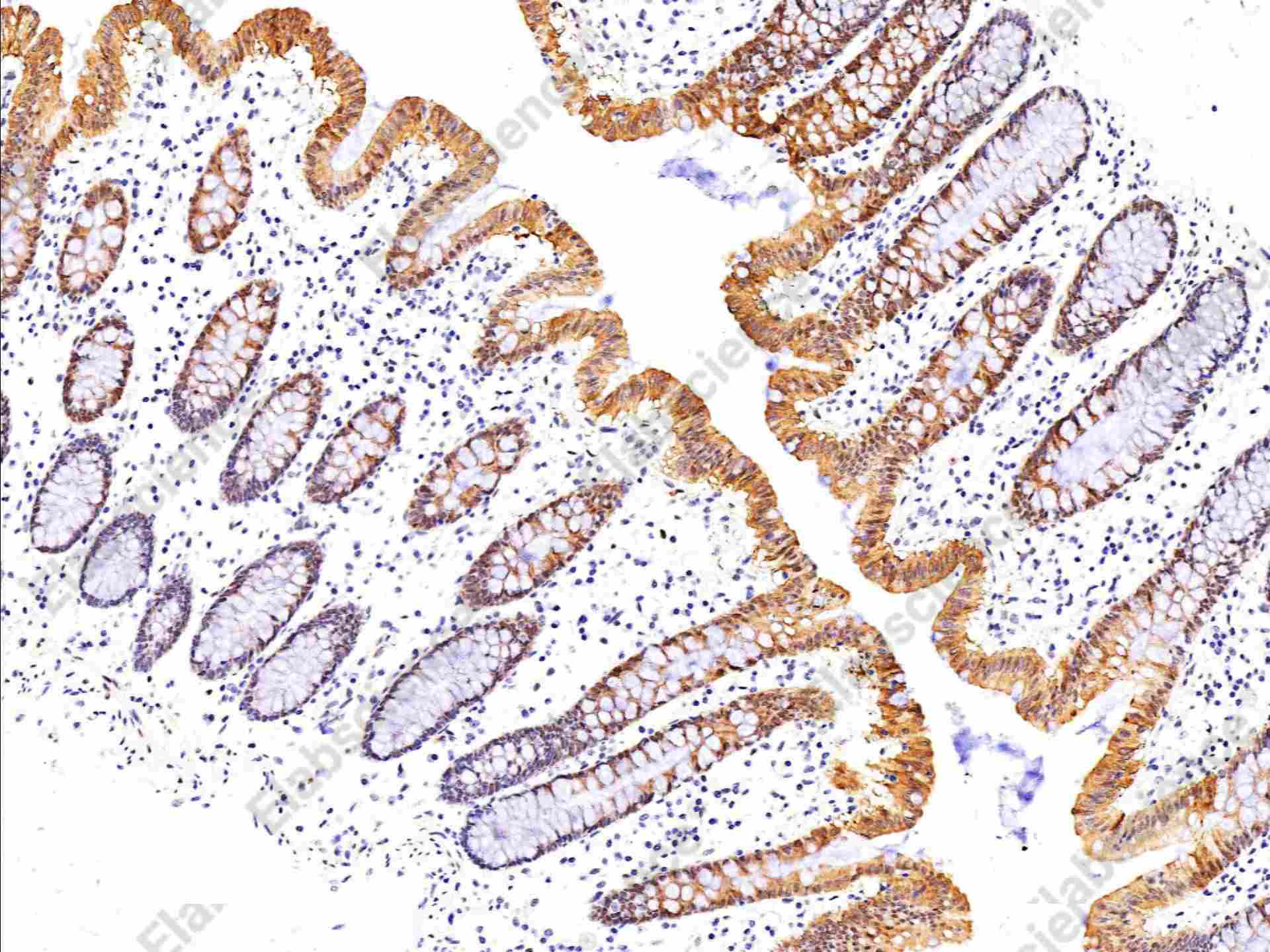 Recombinant Phospho-p90RSK (Thr359, Ser363) Monoclonal Antibody - 1