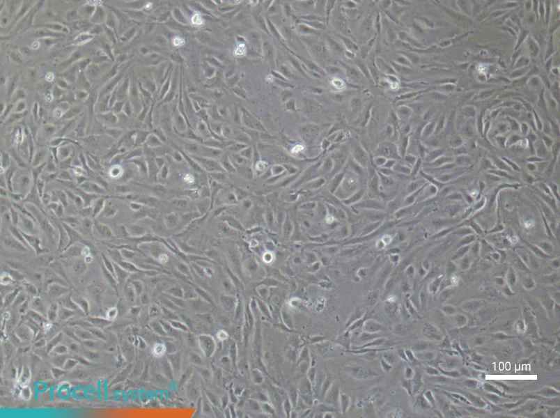 Human Lymphatic Endothelial (Primary cell immortalization) Cell Complete Medium - 3
