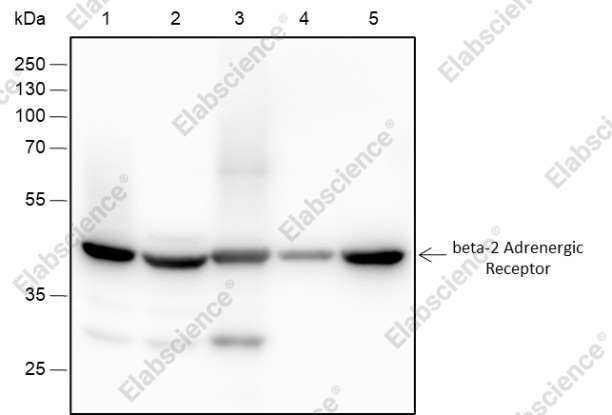 Recombinant beta-2 Adrenergic Receptor Monoclonal Antibody - 1