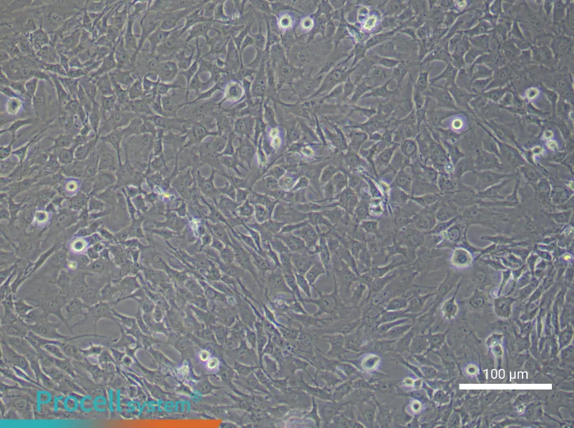 Human Chondrocyte (Primary cell immortalization) Complete MediumHuman Chondrocyte (Primary cell immortalization) Complete Medium - 3