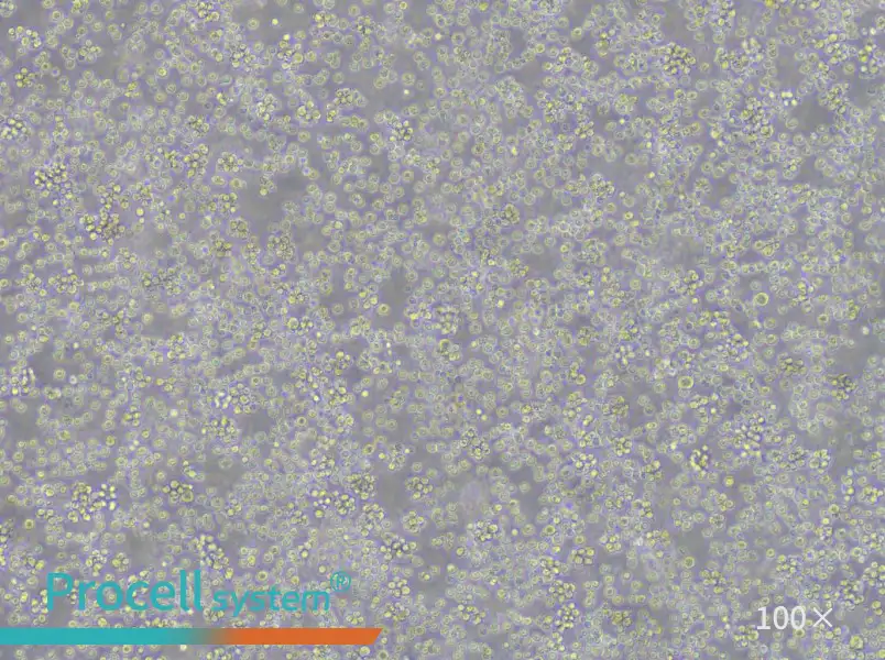 REC-1 Cell Complete Medium - 1