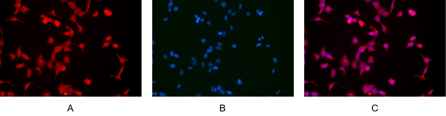Recombinant SQSTM1/p62 Monoclonal Antibody - small - 8