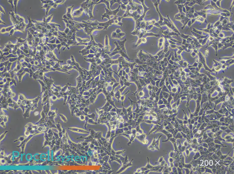 22RV1 Cell Complete Medium - small - 5