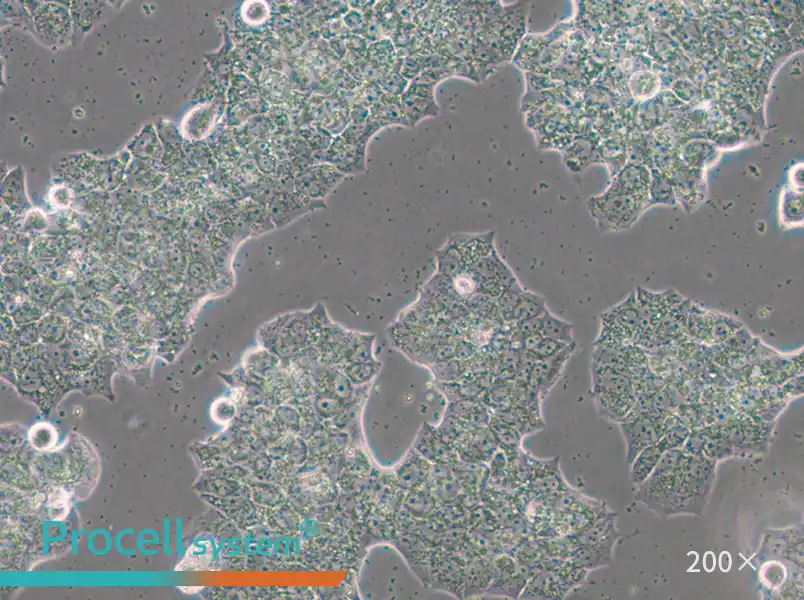 BT-474 [BT474] Cell Complete Medium - small - 6