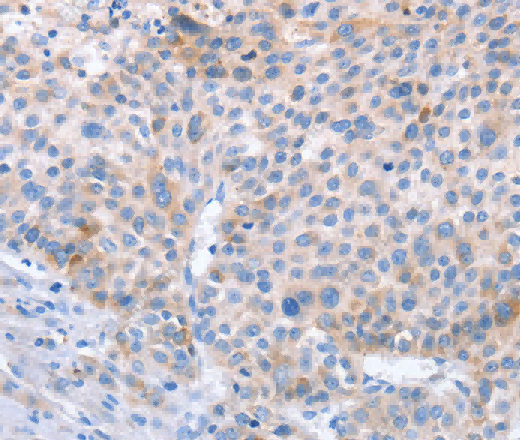 STK4 Polyclonal Antibody - 2