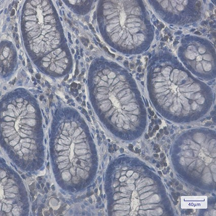 Recombinant Rab8A Monoclonal Antibody - 3