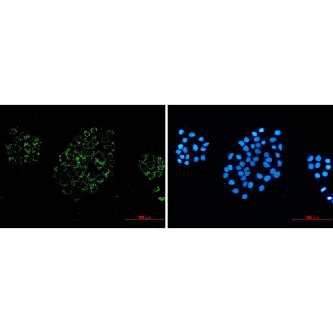 Immunofluorescence of ACOX1  (green) in hela using ACOX1 Rabbit mAb at dilution 1/50, and DAPI(blue)