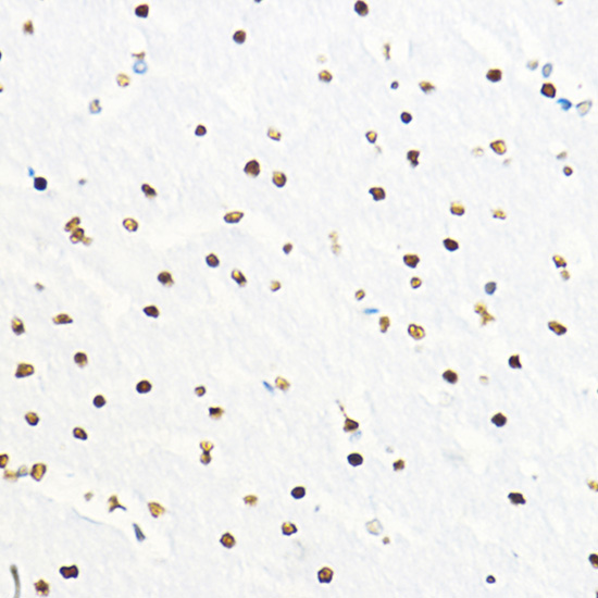 Immunohistochemistry of paraffin-embedded rat brain using ZEB2 Polyclonal Antibody at dilution of 1:100 (40x lens).Perform high pressure antigen retrieval with 10 mM citrate buffer pH 6.0 before commencing with IHC staining protocol.