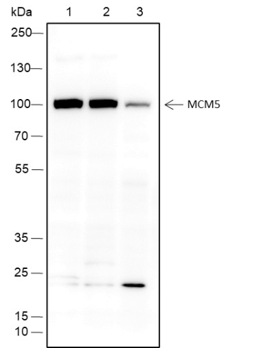 Recombinant MCM5 Monoclonal Antibody-searchlist-1