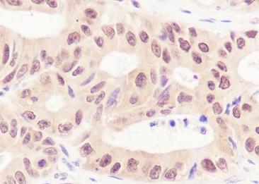 Recombinant Casein Kinase 2 beta Monoclonal Antibody-searchlist-2