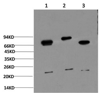 Western Blot analysis of 1) Hela, 2) 3T3, 3) Rat brain using Ubiquitin Monoclonal Antibody at dilution of 1:1000.