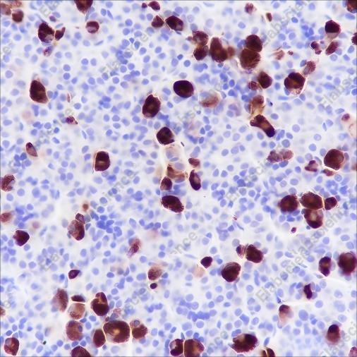 Recombinant FSH beta Monoclonal Antibody - 3