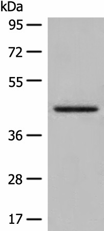 Western blot analysis of Human kidney tissue lysate  using DHRS7 Polyclonal Antibody at dilution of 1:400