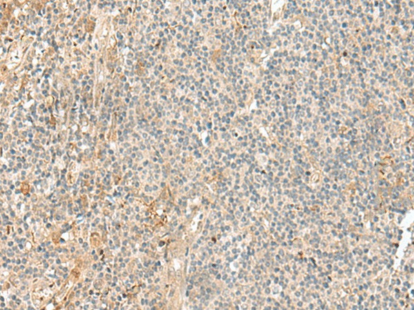 Immunohistochemistry of paraffin-embedded Human tonsil tissue  using NGEF Polyclonal Antibody at dilution of 1:35(?200)