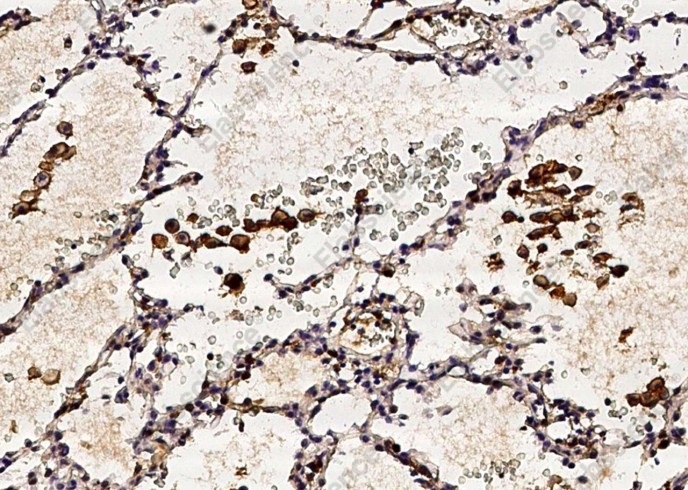 CD16a/FCGR3A Monoclonal Antibody - 2