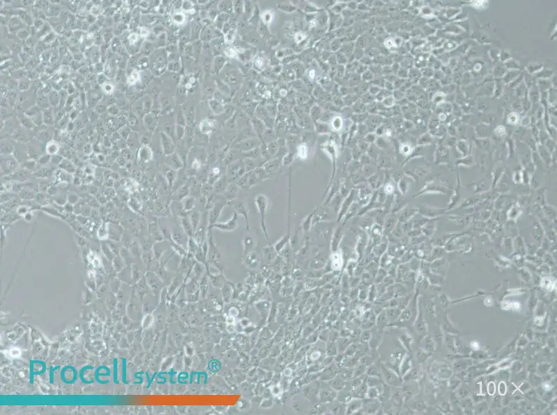 UM-SCC-1 Cell Complete Medium - 1