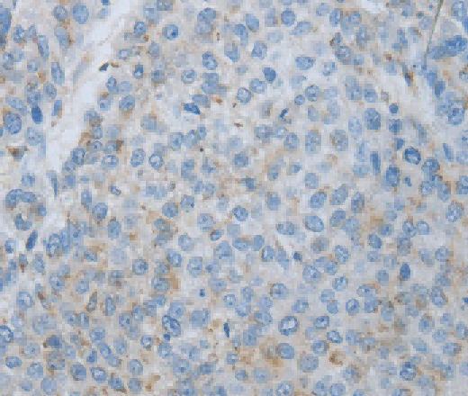 MMP25 Polyclonal Antibody - 3