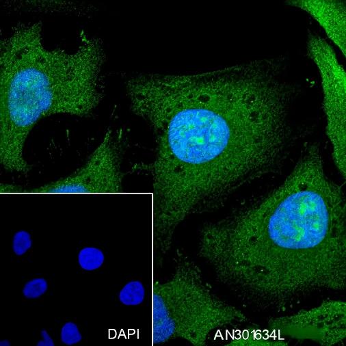 Recombinant PPP1CB Monoclonal Antibody - 3