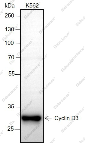 Recombinant Cyclin D3 Monoclonal Antibody - 1