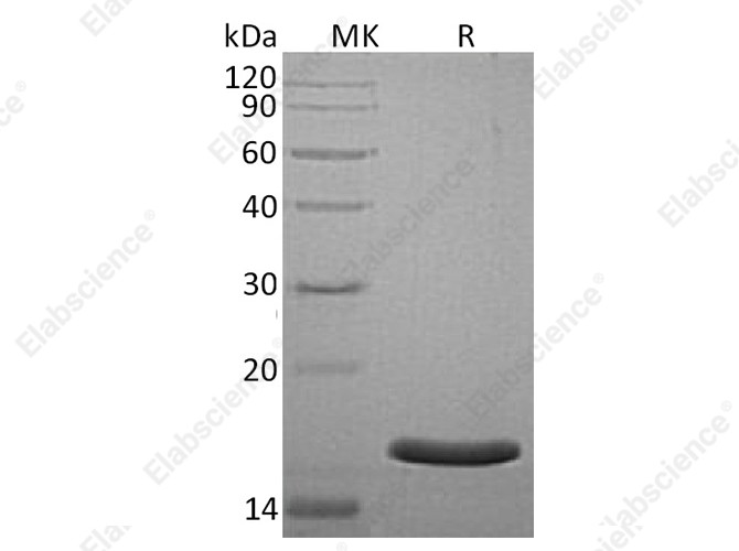 Recombinant Human AGR3 Protein (His Tag) - 1