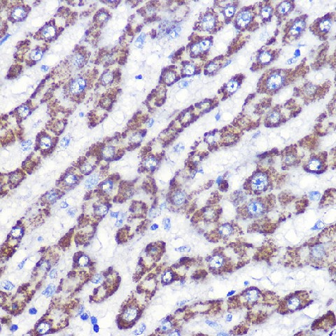 Immunohistochemistry of paraffin-embedded human liver using UCP3 Polyclonal Antibody at dilution of 1:100 (40x lens).Perform microwave antigen retrieval with 10 mM Tris/EDTA buffer pH 9.0 before commencing with IHC staining protocol.