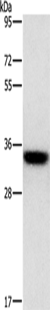 Western Blot analysis of PC3 cell using HOXB13 Polyclonal Antibody at dilution of 1:800