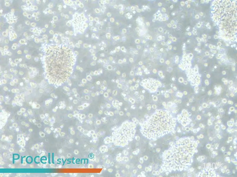 P3HR-1 Cell Complete Medium - 1