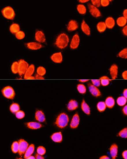 Immunofluorescence analysis of Hela cells using GSTK1 Polyclonal Antibody at dilution of  1:100 (40x lens). Blue: DAPI for nuclear staining.