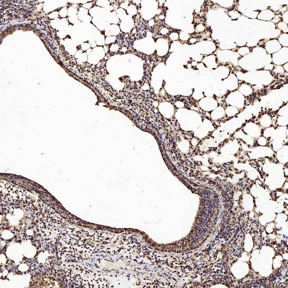 Immunohistochemistry analysis of paraffin-embedded mouse lung  using PTEN Polyclonal Antibody at dilution of 1:200.