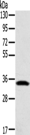 Western Blot analysis of Mouse lung tissue using STX11 Polyclonal Antibody at dilution of 1:400