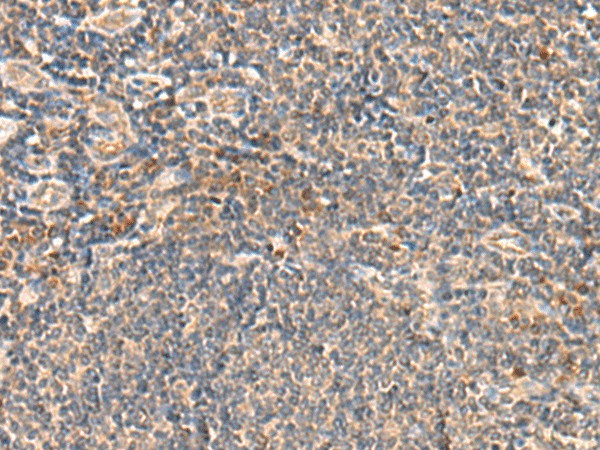 Immunohistochemistry of paraffin-embedded Human tonsil tissue  using SEC22B Polyclonal Antibody at dilution of 1:60(?200)