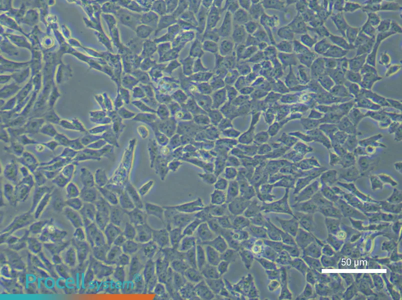 Mouse Pulmonary Artery Endothelial Cells (Primary cell immortalization)Mouse Pulmonary Artery Endothelial Cells (Primary cell immortalization) - 5