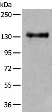 Western blot analysis of Mouse brain tissue lysate  using PTPRA Polyclonal Antibody at dilution of 1:400