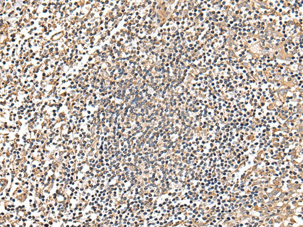 Immunohistochemistry of paraffin-embedded Human tonsil tissue  using MRPS18C Polyclonal Antibody at dilution of 1:25(?200)