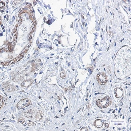 Recombinant PPP1CB Monoclonal Antibody - 2