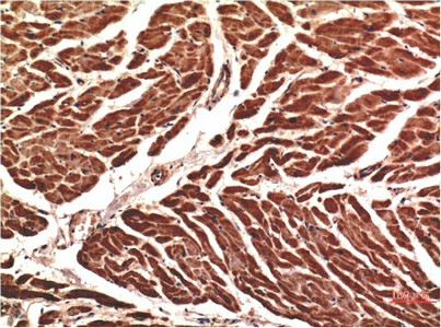 Immunohistochemistry of paraffin-embedded Human heart tissue using VE-Cadherin Monoclonal Antibody at dilution of 1:200.