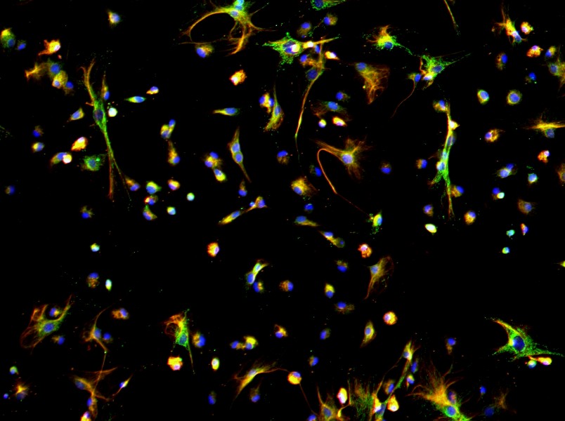 Mouse Peritoneal Mesothelial Cell Complete Medium-searchlist-1