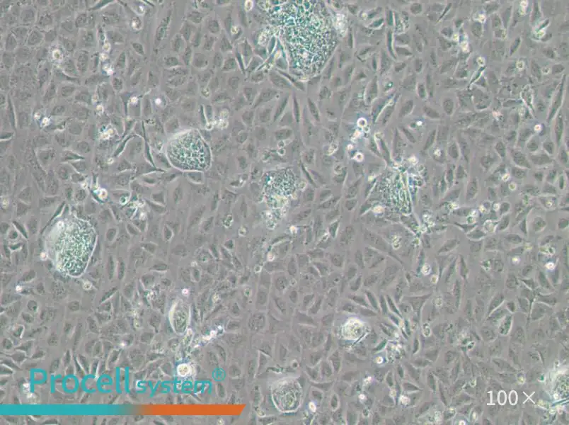 TR-LCC-1 Cell Complete Medium - 1