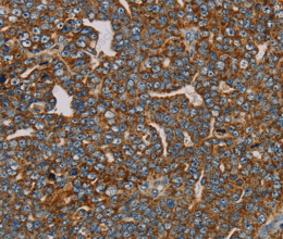 MRPL28 Polyclonal Antibody - 3
