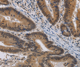 KCNG4 Polyclonal Antibody - 2