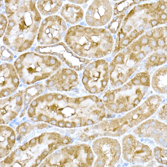 Immunohistochemistry of paraffin-embedded rat kidney using IRE1 Polyclonal Antibody at dilution of 1:100 (40x lens).Perform high pressure antigen retrieval