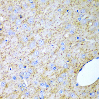 Immunohistochemistry of paraffin-embedded Rat brain using INHA Polyclonal Antibody at dilution of  1:200 (40x lens).