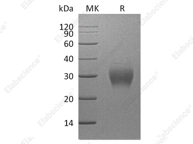 Recombinant Human Fibrillin-1/FBN1 Protein (His Tag) - 1