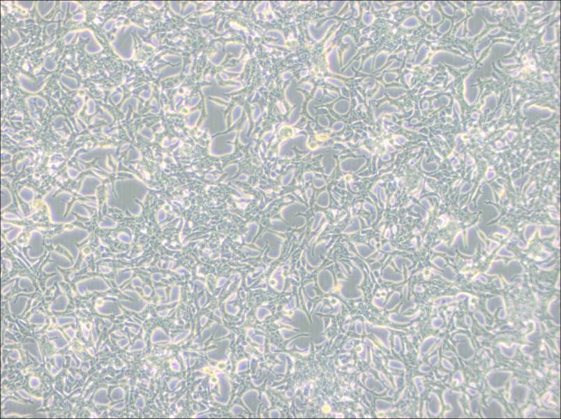 LNCaP clone FGC Cell Complete Medium-searchlist-1