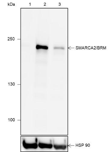 Recombinant SMARCA2/BRM Monoclonal Antibody-searchlist-1
