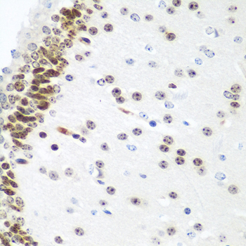 Immunohistochemistry of paraffin-embedded Mouse brain using UBE2U Polyclonal Antibody at dilution of 1:100 (40x lens).